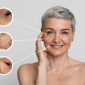 Stock image of model showing skin aging