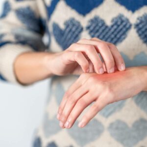 Woman scratching at eczema triggers
